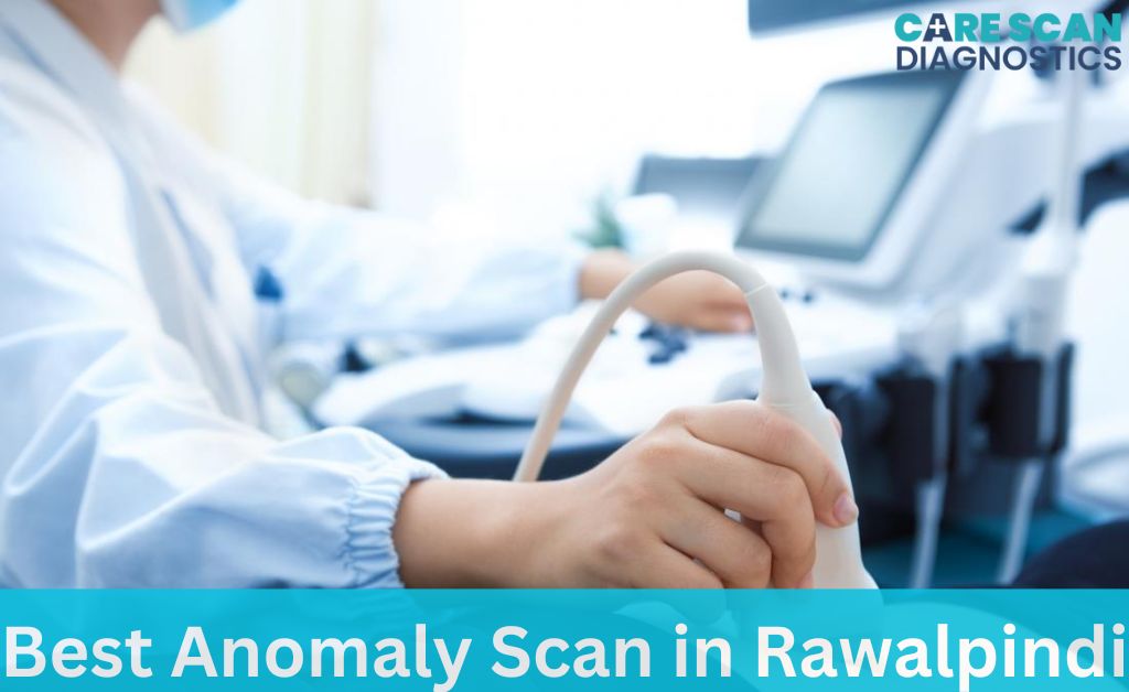 Best Anomaly Scan in Rawalpindi