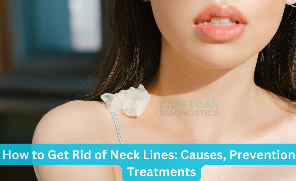 How to Get Rid of Neck Lines: Causes, Prevention & Treatments