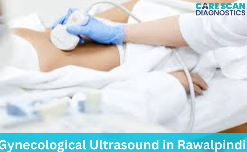 Gynecological Ultrasound in Rawalpindi