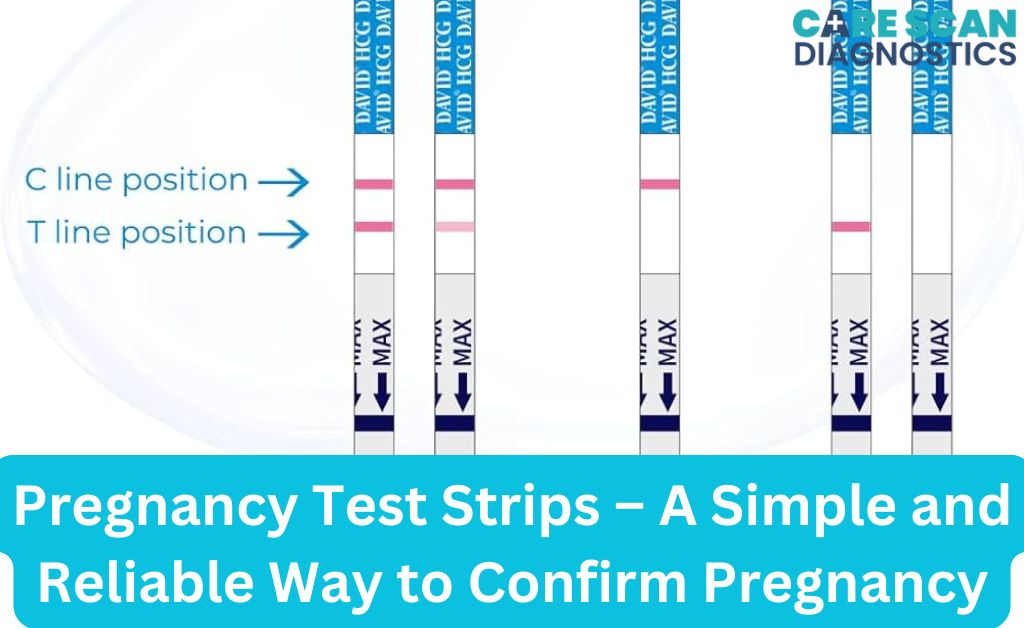 Pregnancy Test Strips