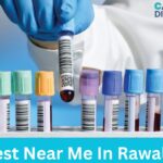 Lab Test Near Me